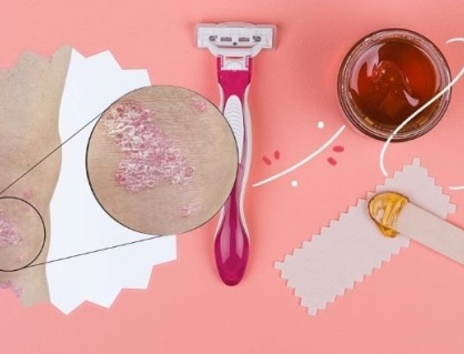Mẹo tẩy lông an toàn cho người bệnh vảy nến