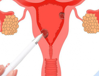 Vì sao PMOS gây thèm đồ ngọt?