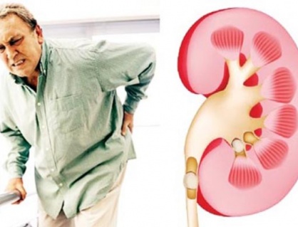 Suy thận mạn ở người cao tuổi: Làm sao để giữ thận khỏe lâu hơn?