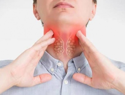 Bướu cổ lành tính có tự nhỏ lại không?