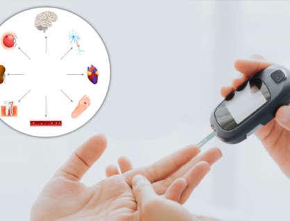 5 nguyên nhân khiến đường huyết tăng cao và cách để kiểm soát