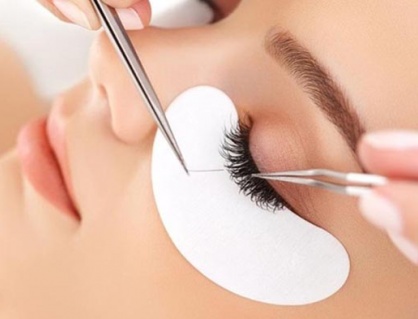 Nhiễm bọ ve trên mí mắt vì nối mi 