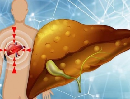 Có thể đảo ngược gan nhiễm mỡ mà không dùng thuốc?