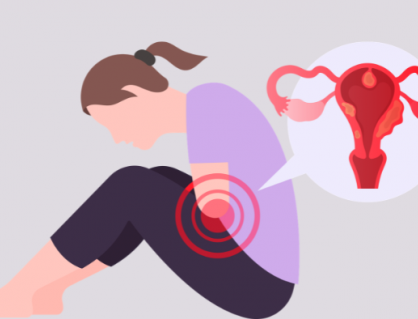 Nhân xơ tử cung có phải ung thư?
