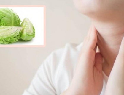 Bị bướu cổ lành tính có nên ăn rau cải bắp?