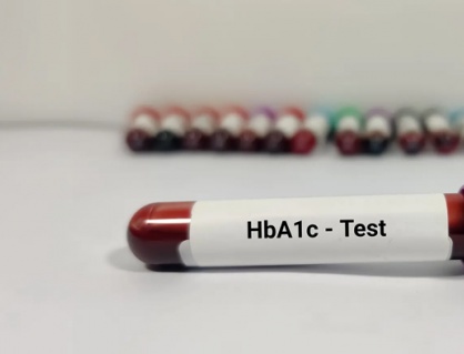 Đái tháo đường: Chỉ số HbA1c 8,9% làm cách nào để hạ?
