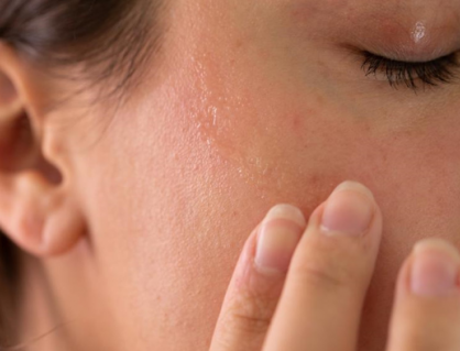 5 nguyên nhân khiến da vẫn khô dù dưỡng ẩm thường xuyên