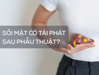 Sỏi mật có tái phát sau phẫu thuật không?