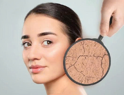 Giải pháp cải thiện tình trạng da khô tại nhà