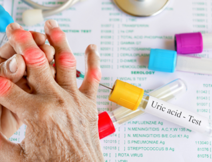 Chế độ ăn cho người có chỉ số acid uric tăng cao