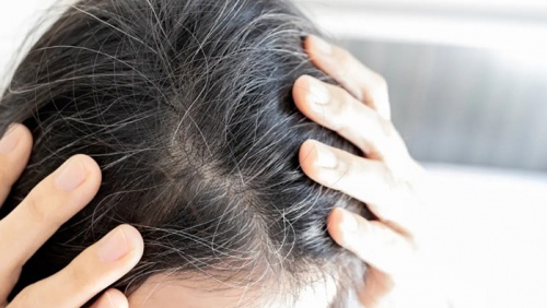 Cách làm chậm quá trình bạc tóc sớm
