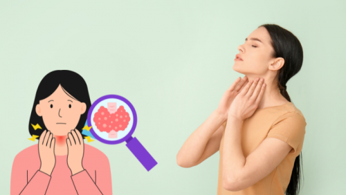 Bướu cổ đơn thuần có đáng lo ngại?