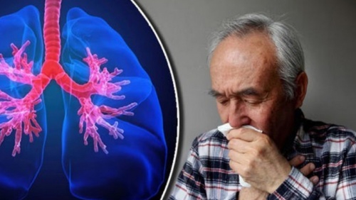 Người bị viêm phổi mạn tính nên điều trị như thế nào?