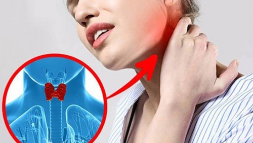 “Điểm mặt” dấu hiệu cảnh báo bệnh tuyến giáp