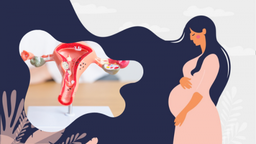 Bị nhân xơ tử cung có thai được không?