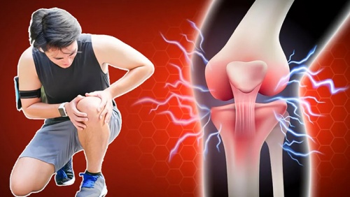“Thủ phạm” gây đau khớp gối ở tuổi 30