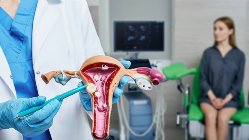 Mối liên hệ giữa u xơ tử cung và bệnh tim mạch ở phụ nữ