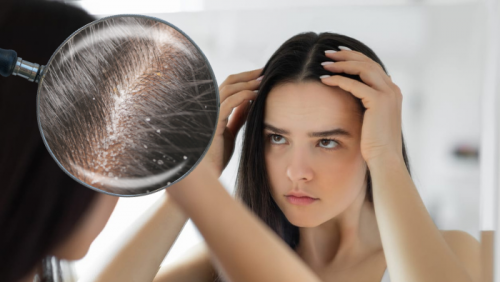 “Cấp cứu” da đầu ngày hanh khô