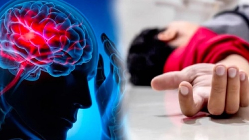 Những ai dễ bị nhồi máu não?