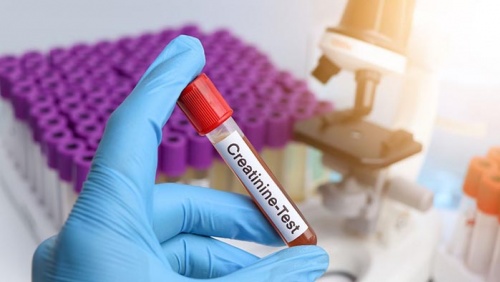 Tại sao chỉ số creatinin lúc tăng lúc giảm?