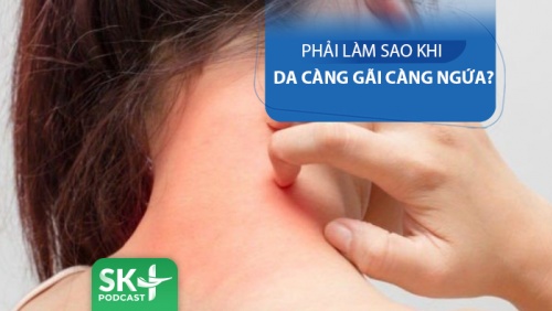 Podcast: Da bị ngứa càng gãi càng ngứa - Làm thế nào?