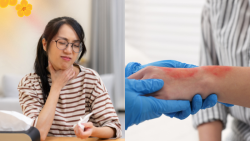 Infographic: Những bước sơ cứu cơ bản tại nhà ngày Tết