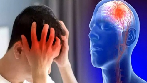 Tai biến mạch máu não có mấy loại?