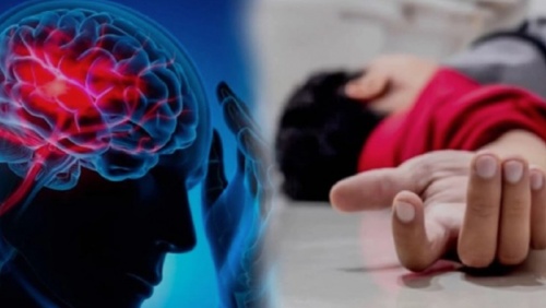 Nguyên nhân gây nhồi máu não thường gặp