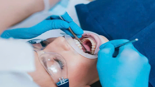 WHO ban hành hướng dẫn mới về phòng và điều trị sâu răng