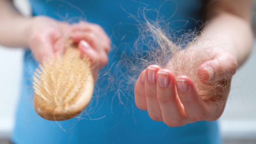 Nhận biết sớm dấu hiệu rụng tóc và cách hạn chế