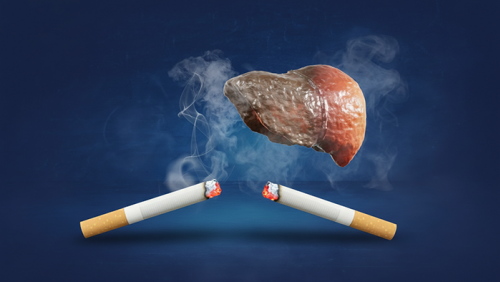 Không chỉ hại phổi, hút thuốc còn gây tổn thương gan