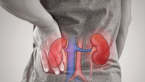 10 thói quen làm tăng nguy cơ suy thận