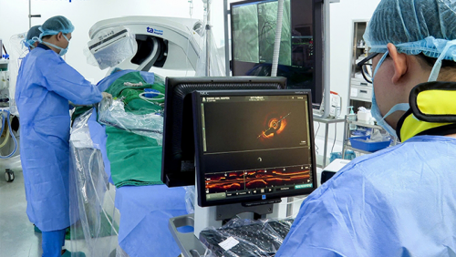 Điều trị vôi hóa động mạch vành bằng sóng xung kích