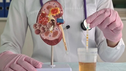 Các yếu tố nguy cơ gây sỏi thận 