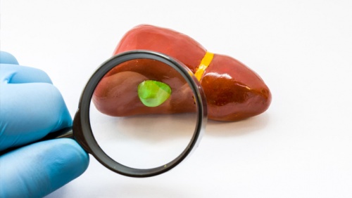 Polyp túi mật có nguy hiểm không?