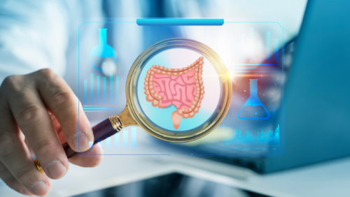 Bác sĩ chỉ ra 5 sai lầm phổ biến làm tăng nguy cơ ung thư đại trực tràng