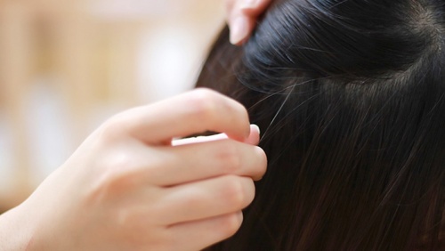 Mới ngoài 20 đã bạc tóc, có cách nào khắc phục?