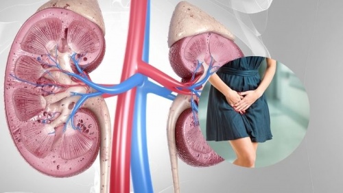 Thói quen chị em nên bỏ để bảo vệ đường tiết niệu