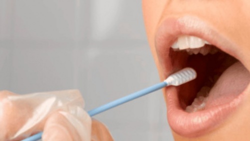 Xét nghiệm nước bọt tại nhà giúp phát hiện sớm ung thư dạ dày