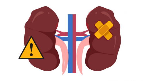 Suy thận độ 1 biểu hiện như thế nào?