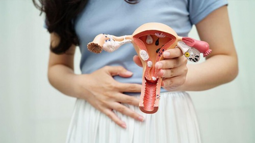 Giải pháp giúp phòng ngừa u xơ tử cung từ sớm