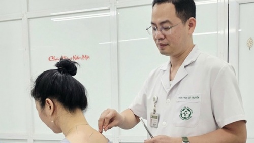 Điều trị đau cổ vai gáy bằng Y học cổ truyền