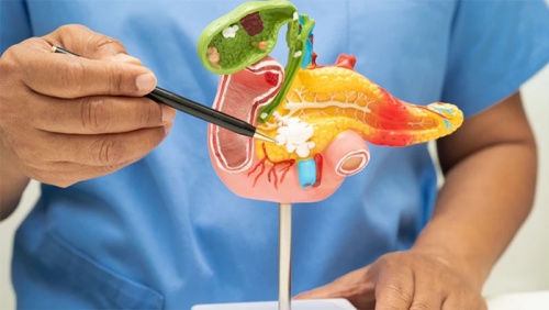Làm thế nào để nhận ra dấu hiệu cảnh báo sỏi mật giai đoạn đầu?