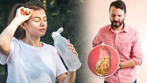Uống ít nước có làm tăng nguy cơ bị sỏi mật không?