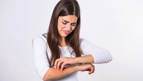 Vảy nến và những ảnh hưởng ít ai ngờ tới