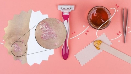Mẹo tẩy lông an toàn cho người bệnh vảy nến