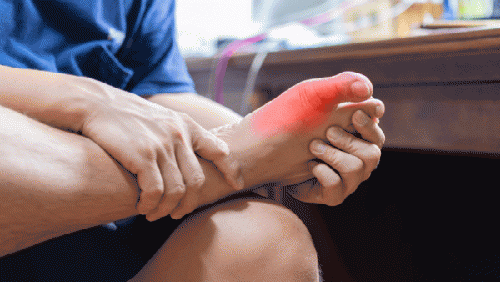 Vì sao người bệnh gout cần chú ý đến sức khỏe tim mạch?