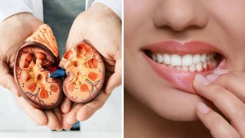 Từ chảy máu chân răng đến nguy cơ tổn thương thận