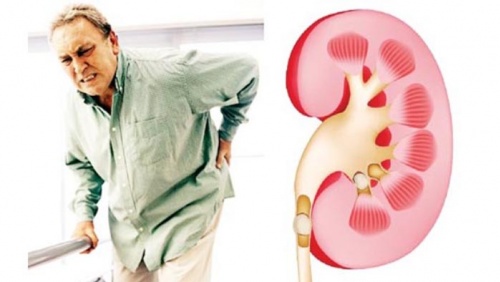 Suy thận mạn ở người cao tuổi: Làm sao để giữ thận khỏe lâu hơn?