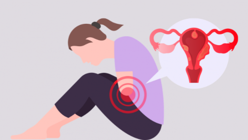 Nhân xơ tử cung có phải ung thư?